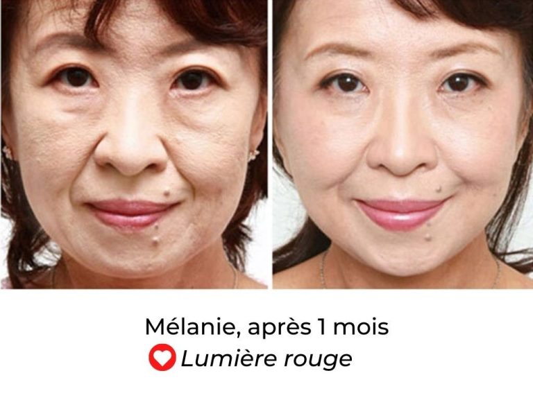 Femme utilisant masque LED facial professionnel maison